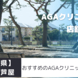【兵庫県】西宮・芦屋のおすすめAGAクリニックを紹介！